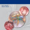 Cholesteatoma 1st Edition 2012