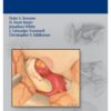 Intracranial Aneurysm Surgery 1st Edition 2012