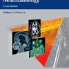 Top 3 Differentials in Neuroradiology 1st Edition 2015