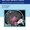 Chordomas Technologies, Techniques, and Treatment Strategies 1st Edition 2016