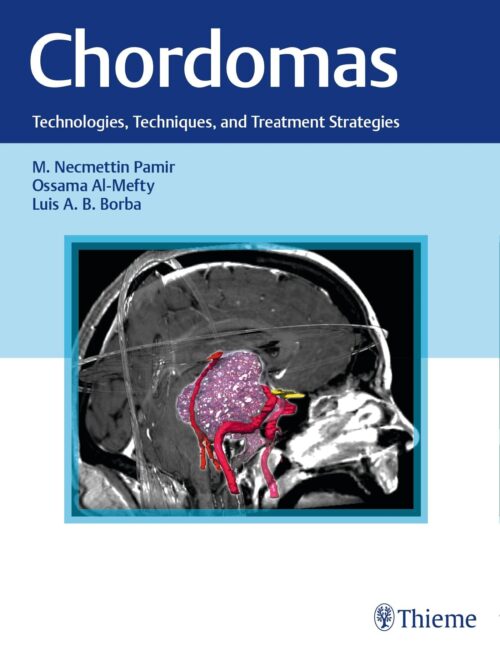 Chordomas Technologies, Techniques, and Treatment Strategies 1st Edition 2016