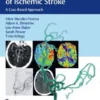 Endovascular Management of Ischemic Stroke 1st Edition 2021