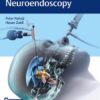Controversies in Neuroendoscopy 1st Edition 2019