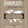 Secondary Rhinoplasty: By the Masters - Two Volume Set 1st Edition 2016