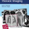 RadCases Plus Q&A Thoracic Imaging 2nd Edition 2018