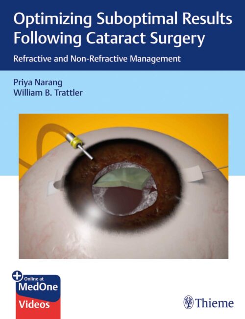 Optimizing Suboptimal Results Following Cataract Surgery 1st Edition 2018