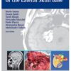 Atlas of Microsurgery of the Lateral Skull Base 2nd Edition 2008