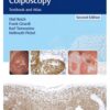 Burghardt's Primary Care Colposcopy 2nd Edition 2017