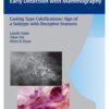 Casting Type Calcifications Sign of a Subtype with 1st Edition 2007