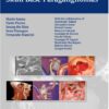 MICROSURGERY OF SKULL BASE PARAGANGLIOMAS 1st Edition 2013