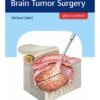 Getting Ready for Brain Tumor Surgery 1st Edition 2017