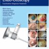 Color Atlas of Endo-Otoscopy 1st Edition 2017