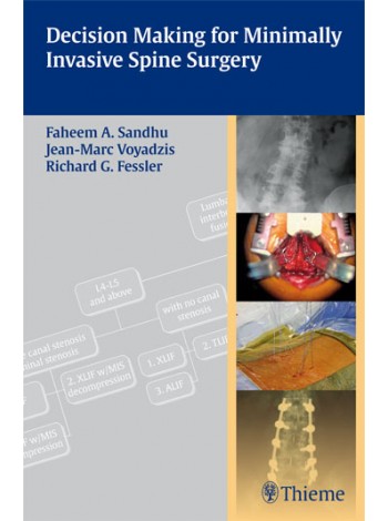 Decision Making for Minimally Invasive Spine Surge Indian Reprint 1st Edition 2011