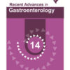 RECENT ADVANCES IN GASTROENTEROLOGY 14