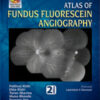 THE SANKARA NETHRALAYA ATLAS OF FUNDUS FLUORESCEIN ANGIOGRAPHY WITH PHOTO DVD-ROM