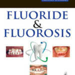 FLUORIDE & FLUOROSIS