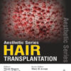 AESTHETIC SERIES:HAIR TRANSPLANTATION