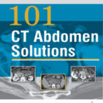 101 CT ABDOMEN SOLUTIONS