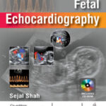 FETAL ECHOCARDIOGRAPHY
