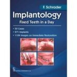 Implantology Fixed Teeth In A Day (Pb 2017)