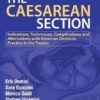 THE CAESAREAN SECITON