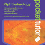 POCKET TUTOR OPHTHALMOLOGY