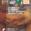 COSMETIC SURGERY AFTER MASSIVE WEIGHT LOSS