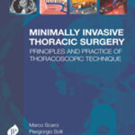 MINIMALLY INVASIVE THORACIC SURGERY PRINCIPLES AND PRACTICE OF THORACOSCOPIC TECHNIQUE