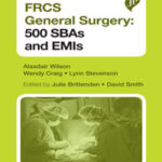 FRCS GENERAL SURGERY SECTION 1: 500 SBAS AND EMIS