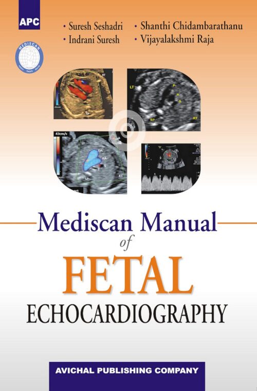 Mediscan Manual of Fetal Echocardiography