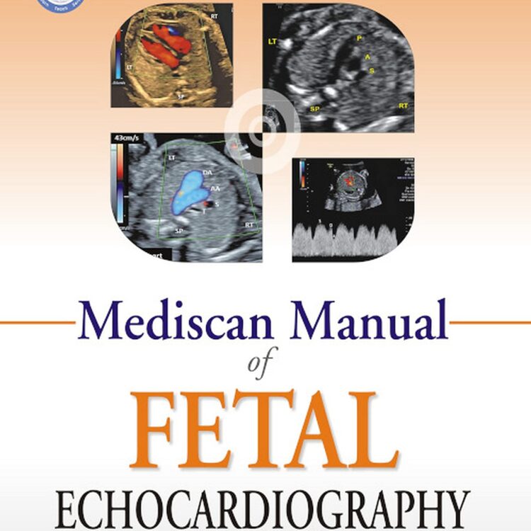 Mediscan Manual of Fetal Echocardiography