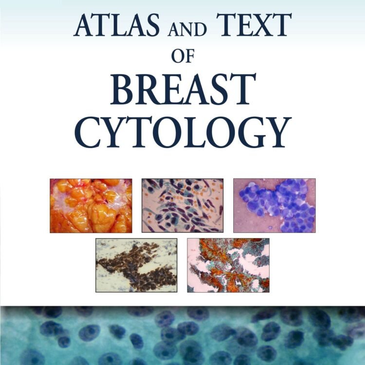Atlas and Text of Breast Cytology