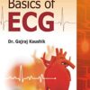 Basics of ECG