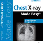 CHEST X-RAY MADE EASY