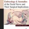 EMBRYOLOGY & ANOMALIES OF THE FACIAL NERVE AND THEIR SURGICAL IMPLICATIONS
