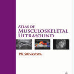 ATLAS OF MUSCULOSKELETAL ULTRASOUND