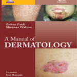 A MANUAL OF DERMATOLOGY