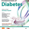 FUNDAMENTAL OF DIABETES