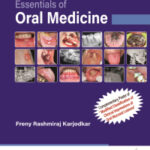 ESSENTIALS OF ORAL MEDICINE