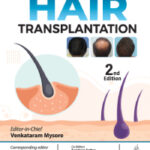 HAIR TRANSPLANTATION
