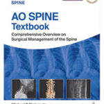 AO SPINE TEXTBOOK: COMPREHENSIVE OVERVIEW ON SURGICAL MANAGEMENT OF THE SPINE