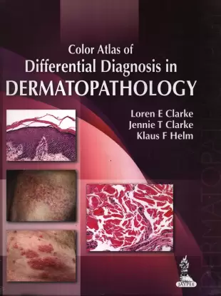 COLOR ATLAS OF DIFFERENTIAL DIAGNOSIS IN DERMATOPATHOLOGY