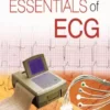 Essentials of ECG