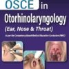 OSCE in Otorhinolaryngology (Ear, Nose & Throat)