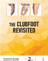 The Clubfoot Revisited