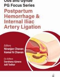 Obs and Gynae PG Focus Series Postpartum Hemorrhage and Internal Iliac Artery Ligation