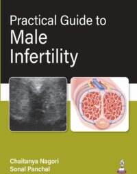 Practical Guide to Male Infertility