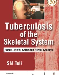 Tuberculosis of the Skeletal System (Bones, Joints, Spine and Bursal Sheaths)