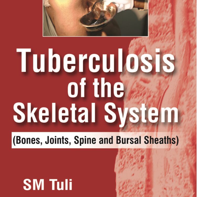 Tuberculosis of the Skeletal System (Bones, Joints, Spine and Bursal Sheaths)