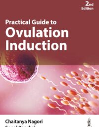 Practical Guide to Ovulation Induction